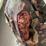 Cvičení Branných oddílů ČR. Žákyně oboru kosmetička vytváří realistické simulace zranění.